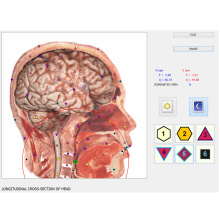 vecteur 8d nls scanner de santé biorésonance lris